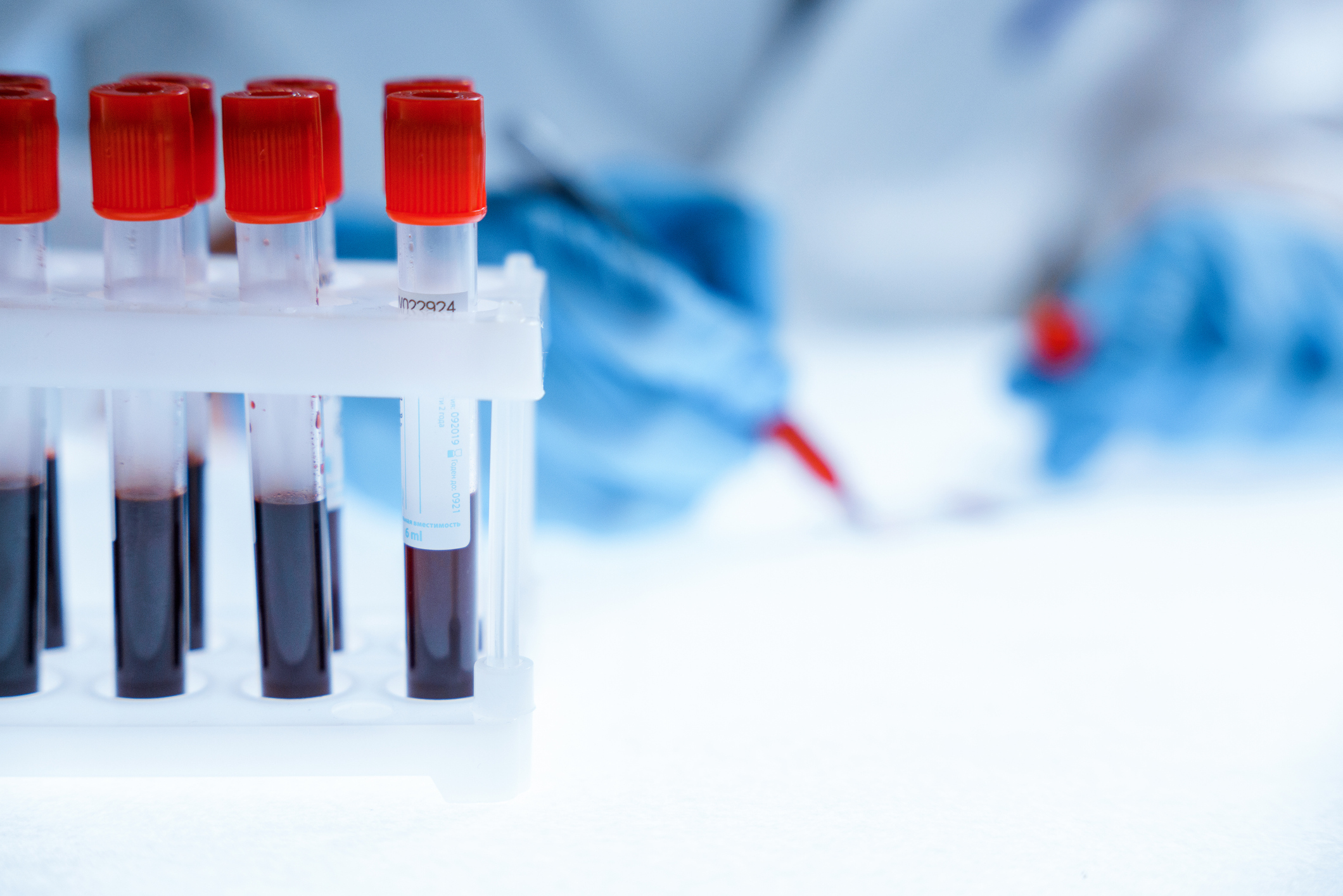 How Long Will Your Test Take?